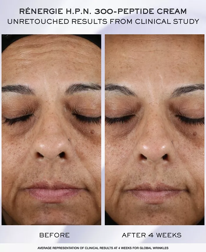 Alfani Lancôme 3-Pc. Rénergie H.C.F. Triple Serum Discovery Set Beauty