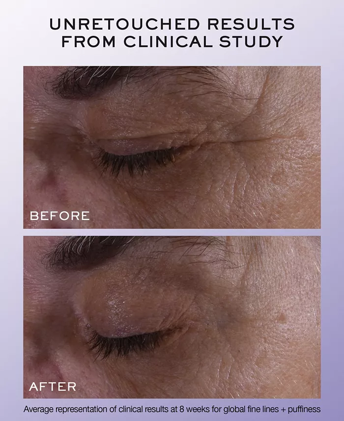 Alfani Lancôme Rénergie H.C.F. Triple Serum Eye 0.67 Oz. Beauty