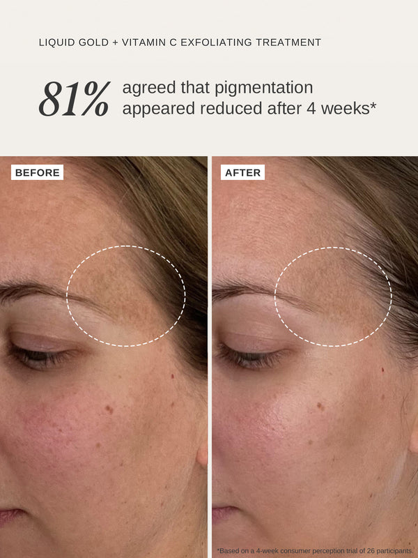 Alpha H Cleanse & Brighten Duo