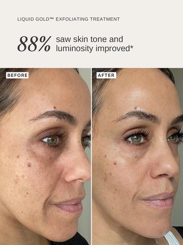 Alpha H Dewy Skin Trio