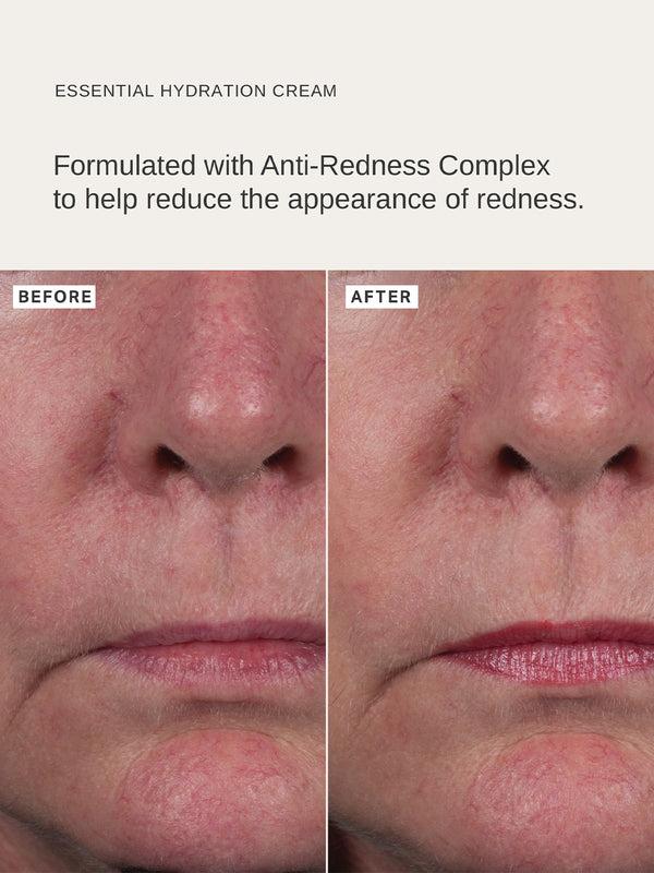 Alpha H Essential Hydration Cream