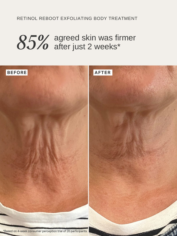 Alpha H Exfoliating Face & Body Duo