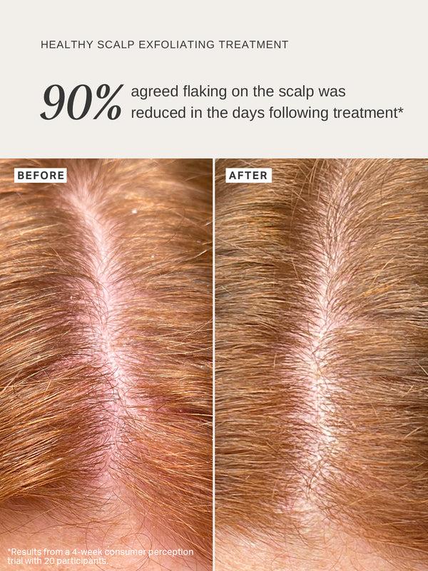Alpha H Healthy Scalp Exfoliating Treatment