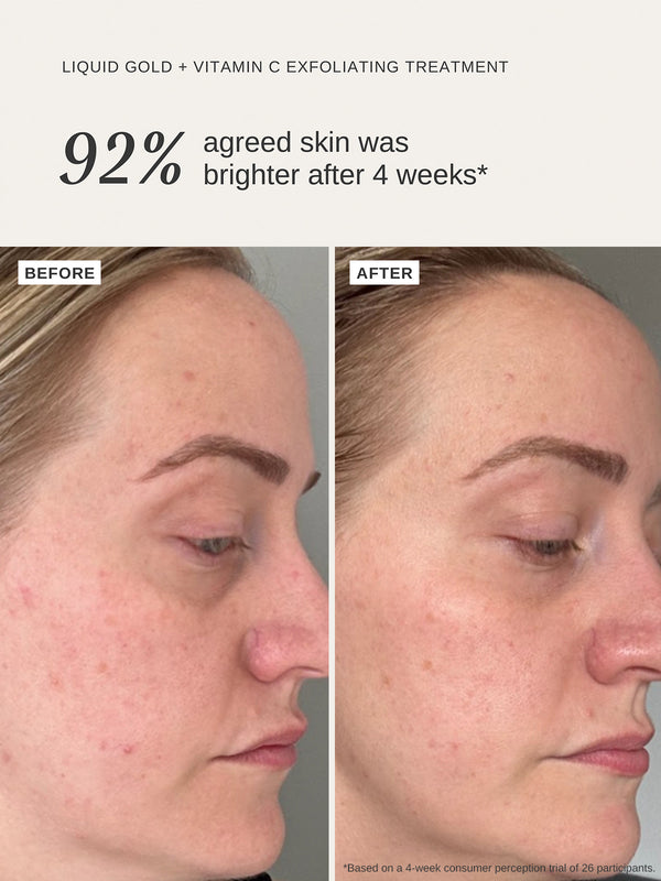 Alpha H Liquid Gold + Vitamin C Trial Kit