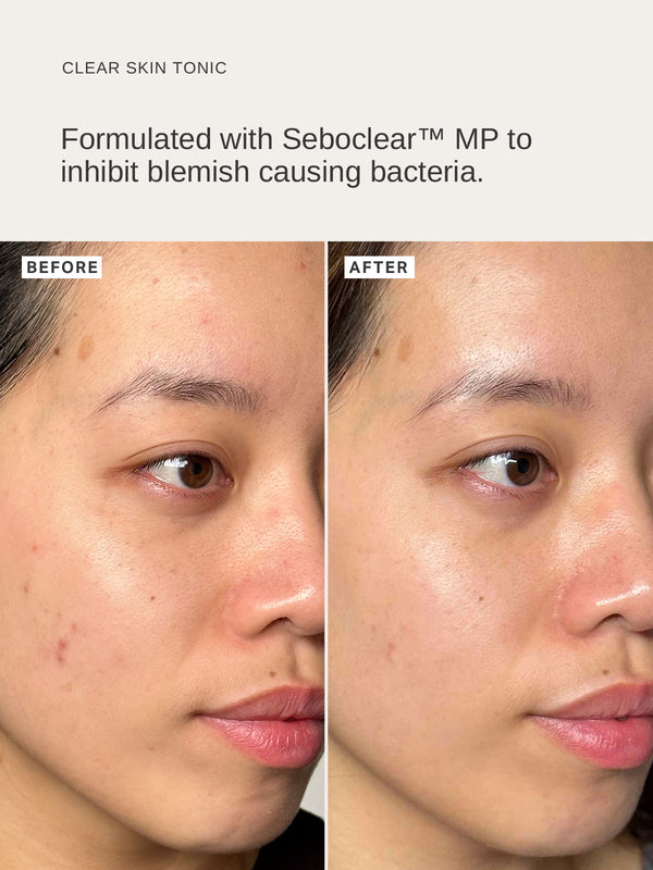 Alpha H Pore-Refining Essentials
