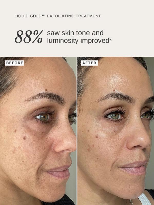 Alpha H Pregnancy Skin Essentials