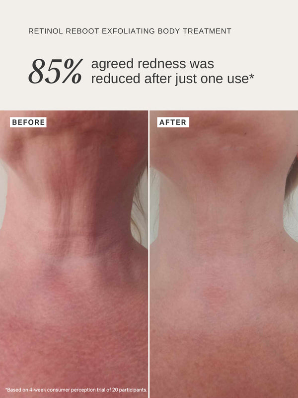 Alpha H Retinol Reboot Exfoliating Body Treatment