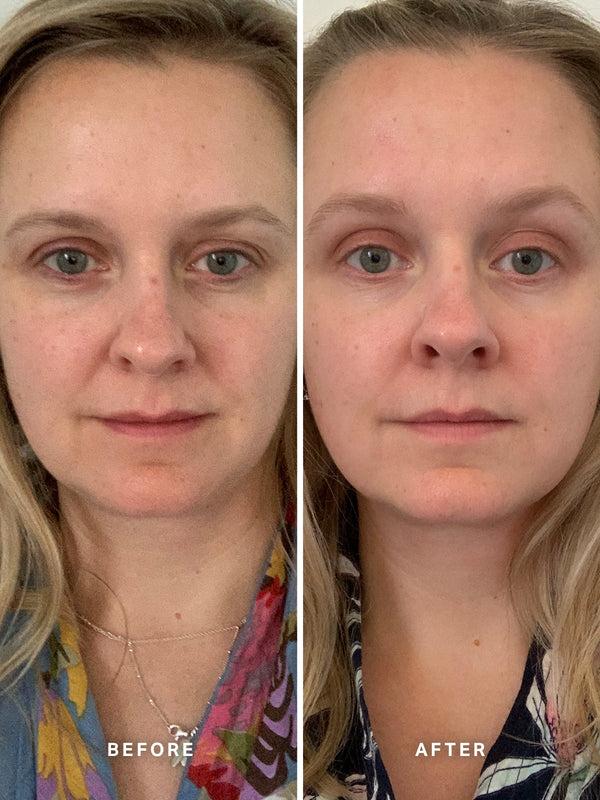 Alpha H Vitamin A Serum With 0.5% Retinol 15ml