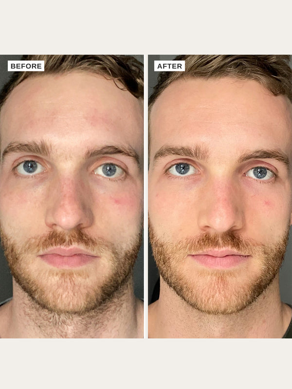 Alpha H Vitamin B Serum With 5% Niacinamide