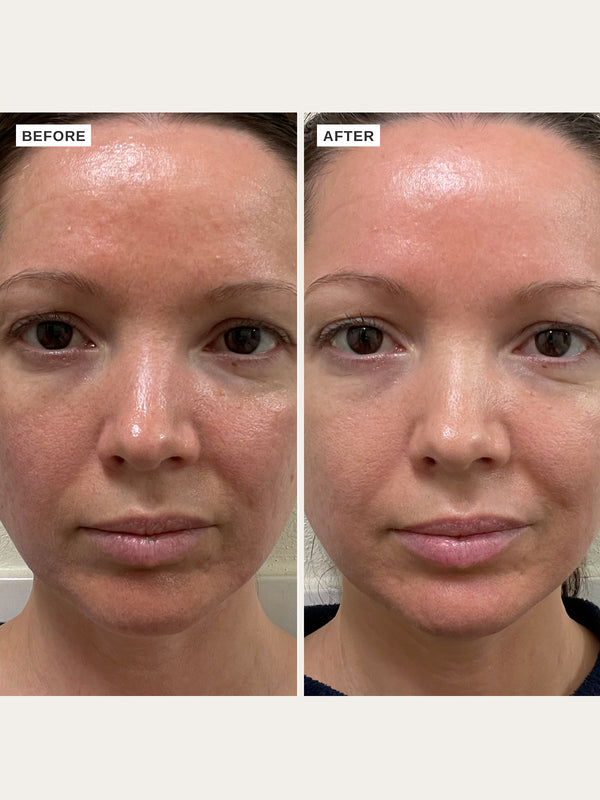 Alpha H Vitamin B Serum With 5% Niacinamide