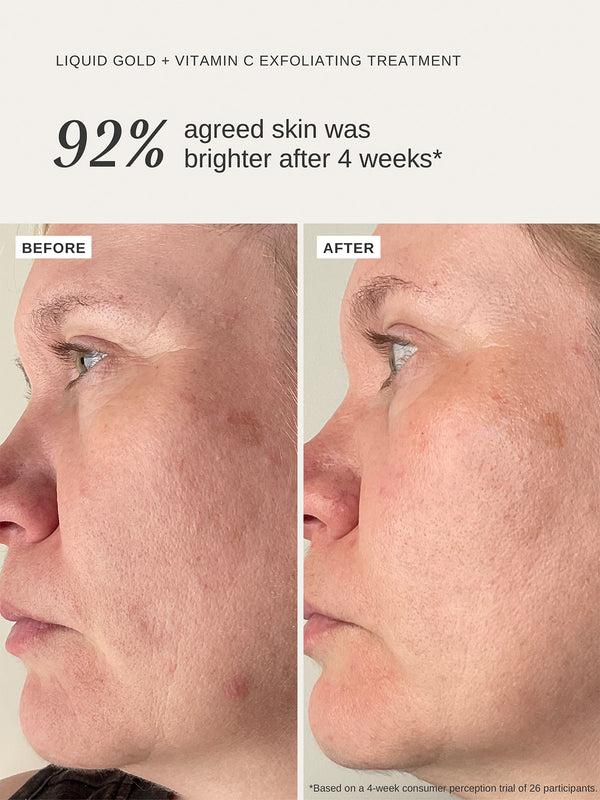 Alpha H Vitamin C Duo