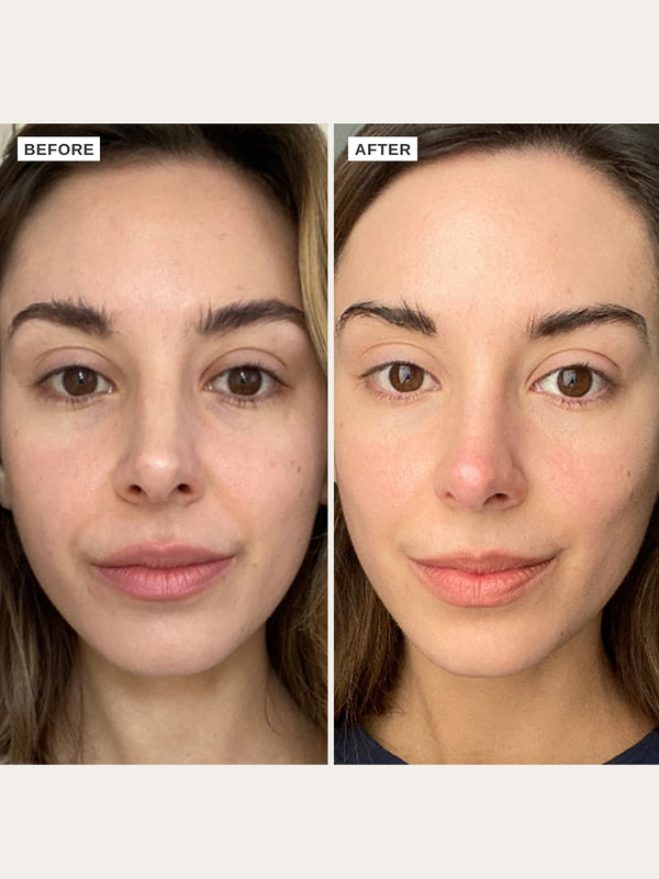 Alpha H Vitamin C Serum With 10% Ethyl Ascorbic Acid