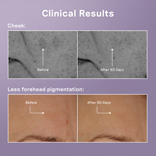 Balance Me Azelaic Dark Spot Serum 30ml