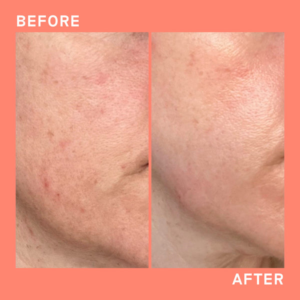 Balance Me Ceramide Barrier Booster 30ml