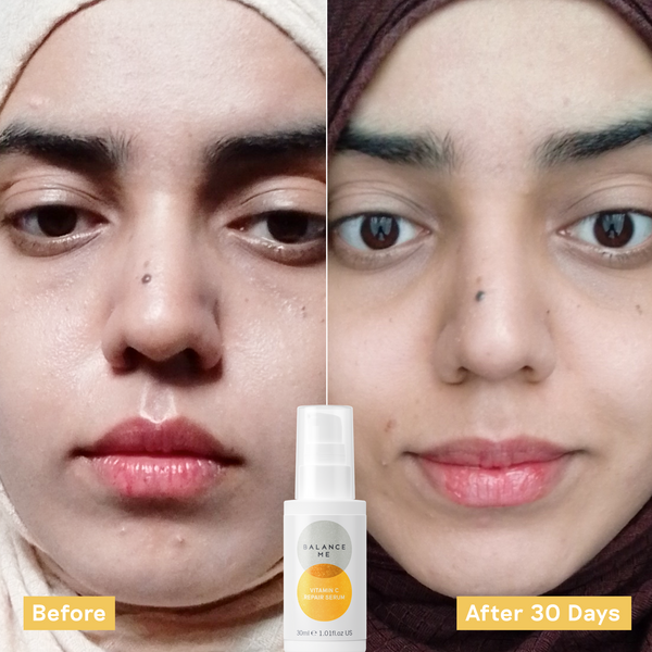 Balance Me Vitamin C Repair Serum 30ml