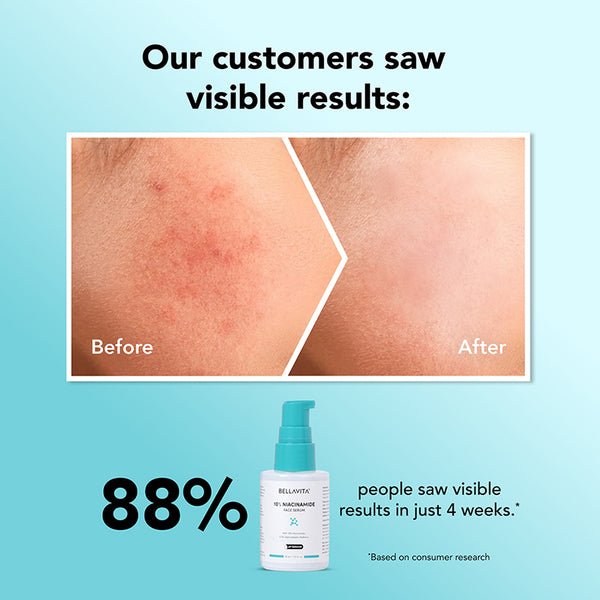 Bella Vita 10% Niacinamide Face Serum - 30ml