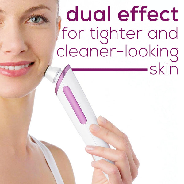 Beurer Microdermabrasion FC76