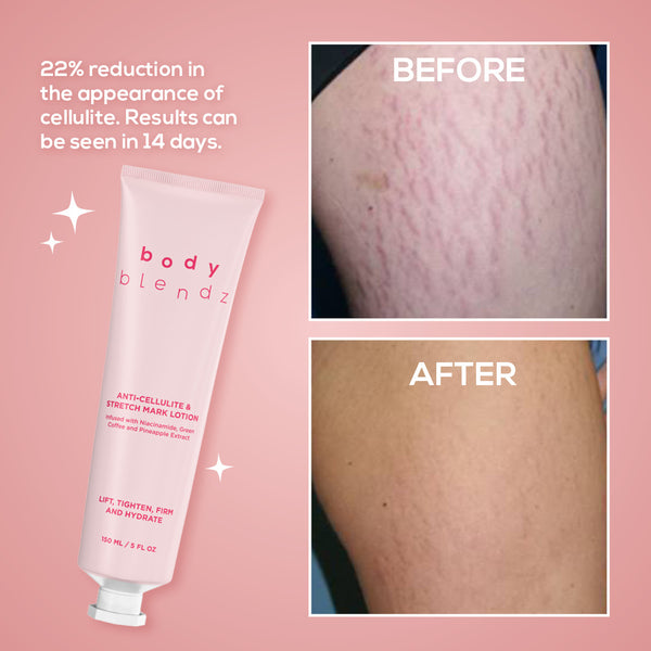Body Blendz Anti-Cellulite & Stretch Mark Lotion
