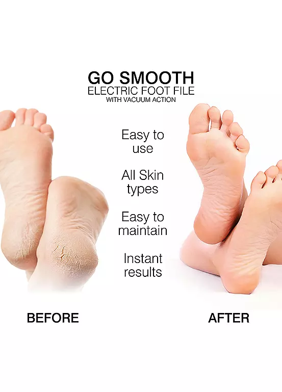 Bonprix Rio Rio Go Smooth Electric Foot File With Vacuum Action