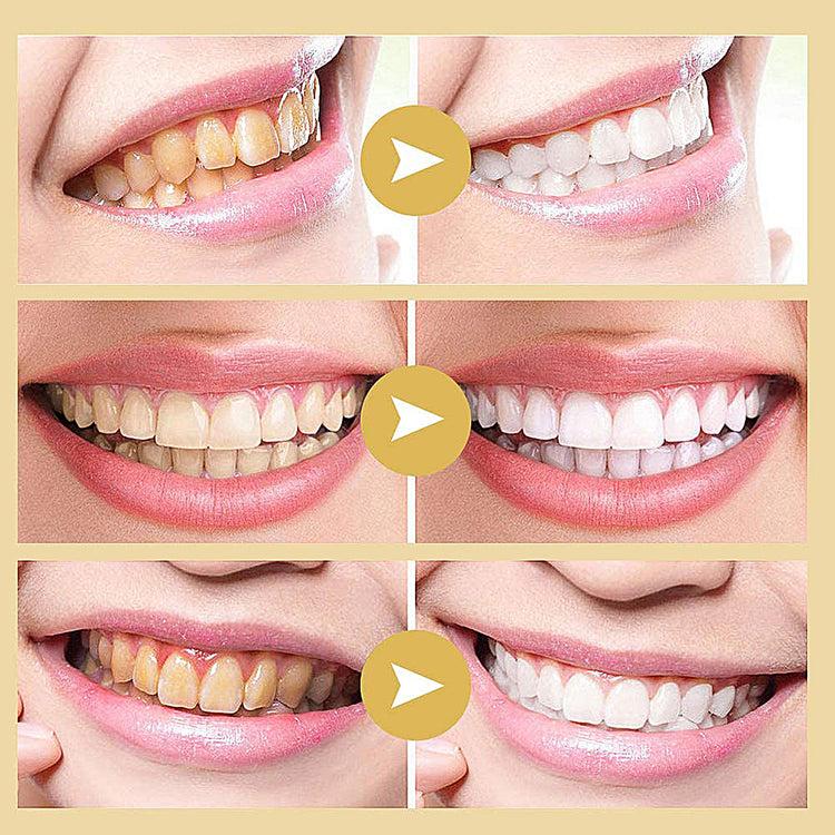 Brookstone Evertone Igia Total White Foam Toothpaste Lemon Flavored