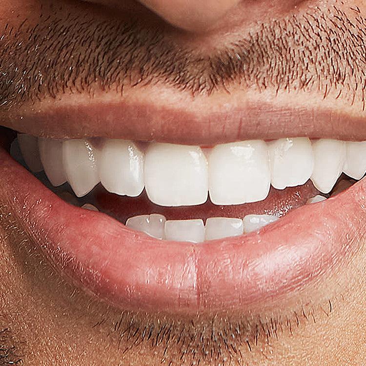 Brookstone Evertone Total White 3 In 1 Hands Free Ultrasonic Toothbrush