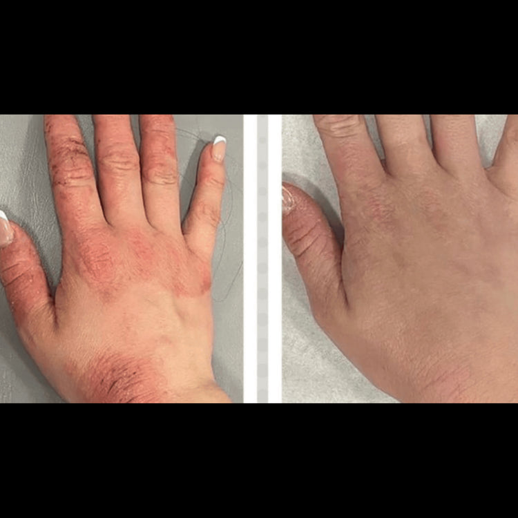 Brookstone Numiere Hand Glow – LED Light Therapy For Hand & Wrist Rejuvenation By Numiere - Lumina NRG