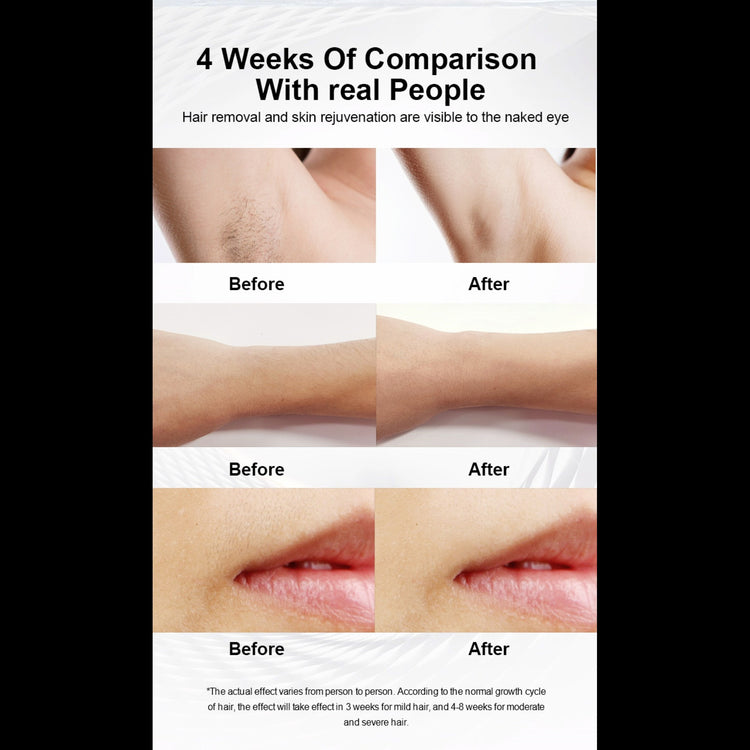 Brookstone Numiere IPL Hair Removal With Ice Cooling By Numiere - Lumina NRG