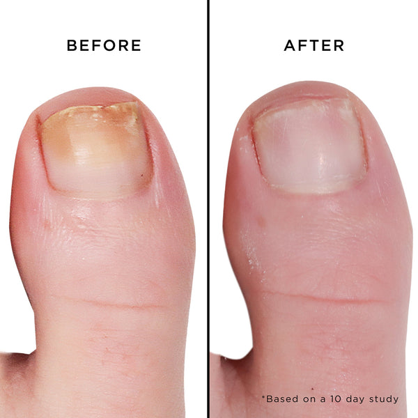 Butter London 3-piece Pro Nail Brightening Kit