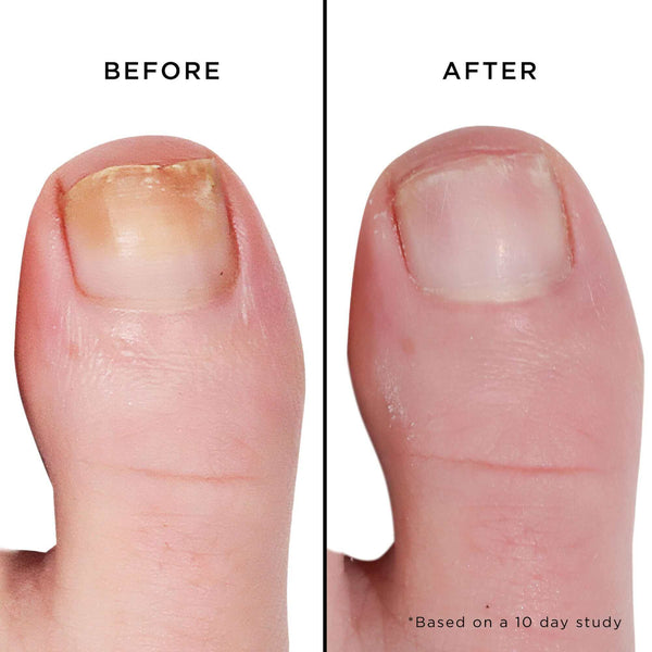 Butter London Mellow The Yellow Nail Brightening Treatment 0.4 Fl Oz