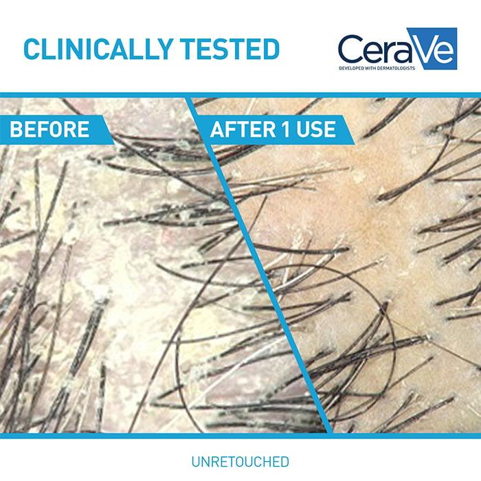 Cerave 2-in-1 Anti-Dandruff Hydrating Shampoo And Conditioner