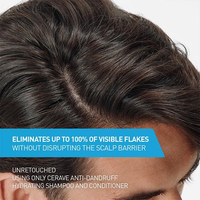Cerave Anti-Dandruff Hydrating Shampoo