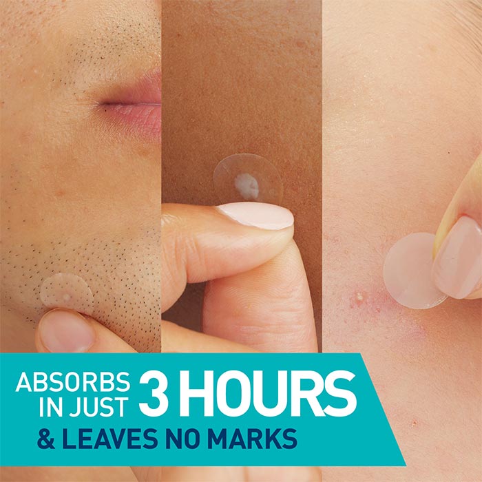 Cerave Blemish Barrier Patches