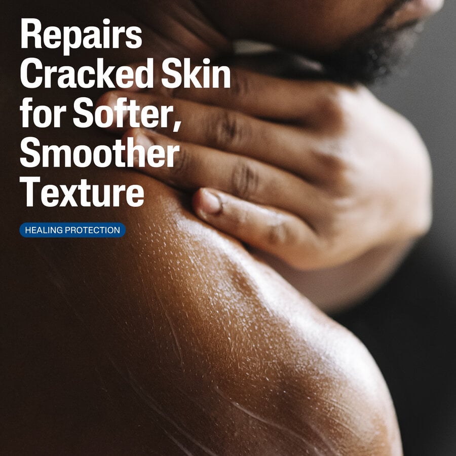 Cetaphil Cracked Skin Repair Lotion