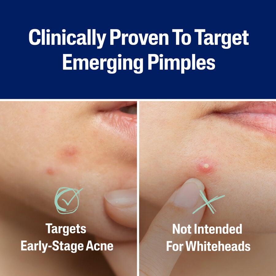 Cetaphil Fast Rescue Pimple Patch