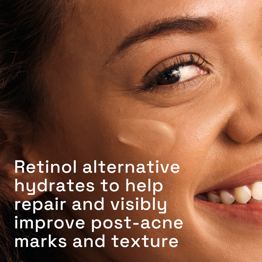 Cetaphil Gentle Clear Repairing Post-Acne Serum