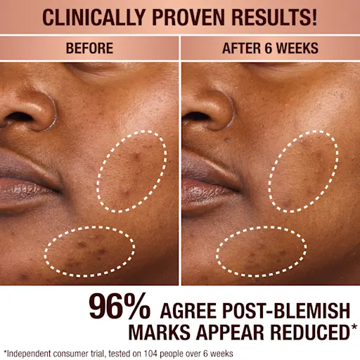 Charlotte Tilbury DARK SPOT CORRECTING INVISIBLE UV DUO SKINCARE KIT