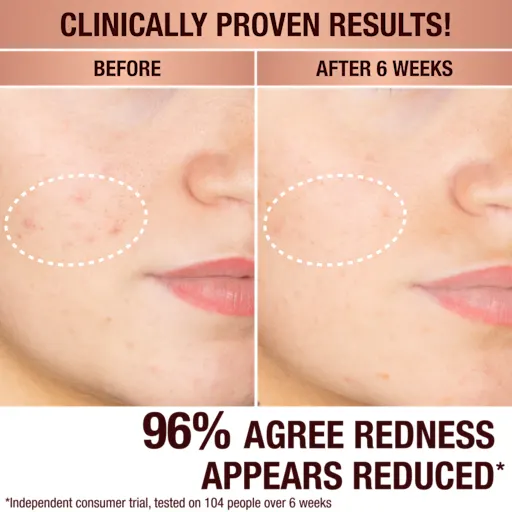 Charlotte Tilbury DARK SPOT CORRECTING PROTECT HYDRATE & GLOW KIT SKINCARE KIT