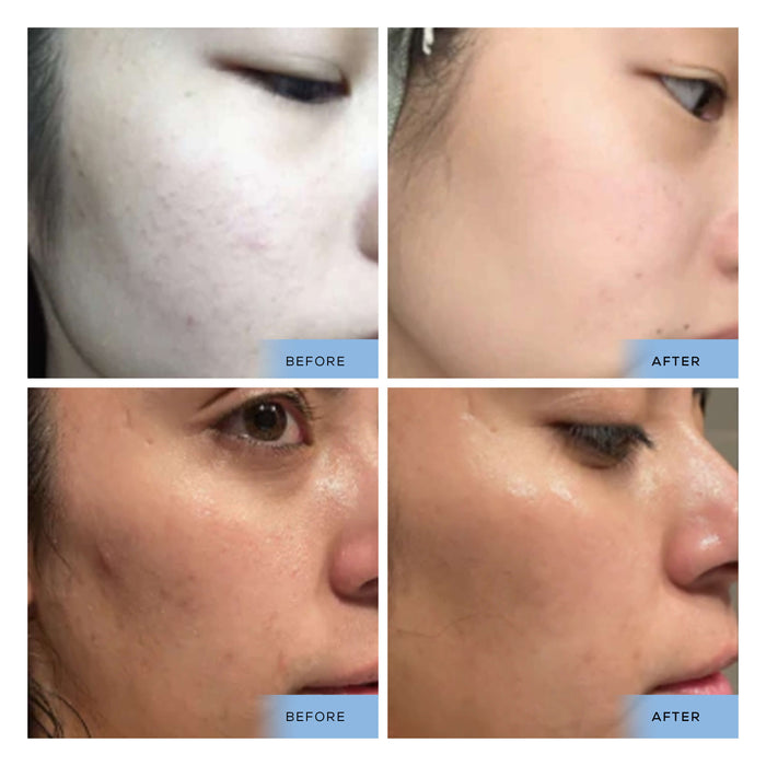 cosmedica Skincare Hyaluronic Acid +Vitamin B5 Serum