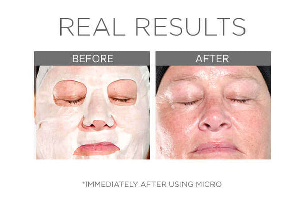 Cosmedix Micro Defense Microbiome Sheet Mask Set 5-pcs