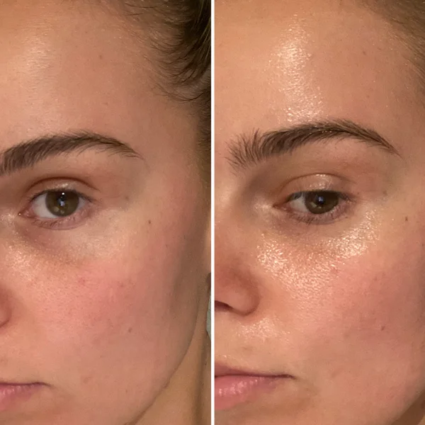 Cult Alpha-H Liquid Gold Midnight Reboot Serum 50ml