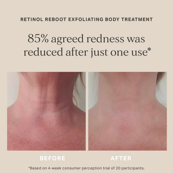 Cult Alpha-H Retinol Reboot Exfoliating Body Treatment With 8% Glycolic Acid 2% Lactic Acid + 1% Encapsuladed Retinol