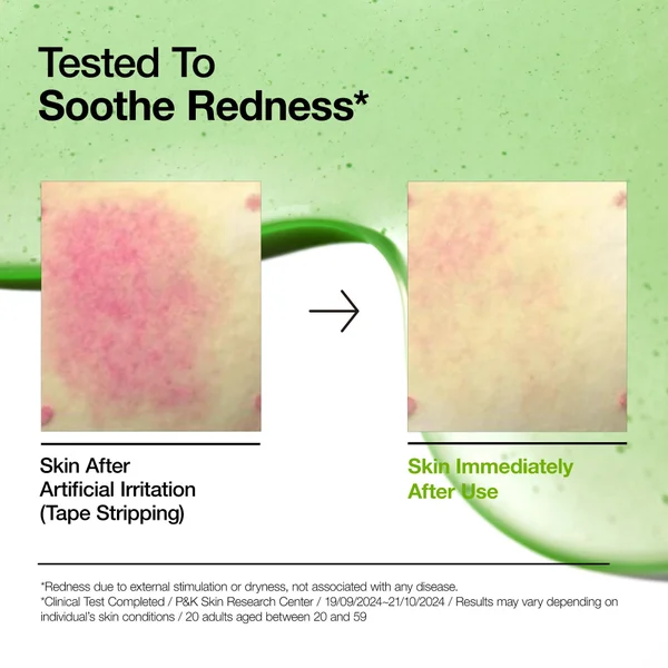 Cult Anua Azelaic Acid 10 Hyaluron Redness Soothing Serum 30ml