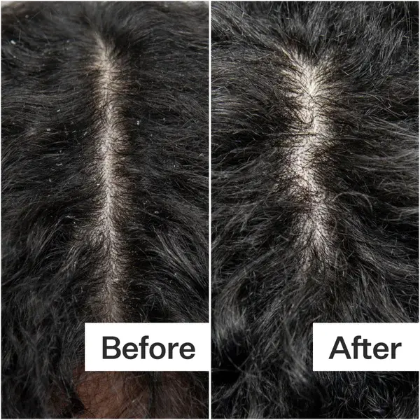 Cult Act+Acre Cold Processed Scalp Detox 3.0 Fl Oz