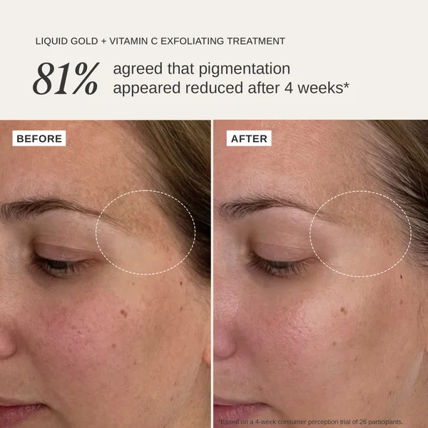 Cult Alpha - H Liquid Gold + Vitamin C Trial Kit