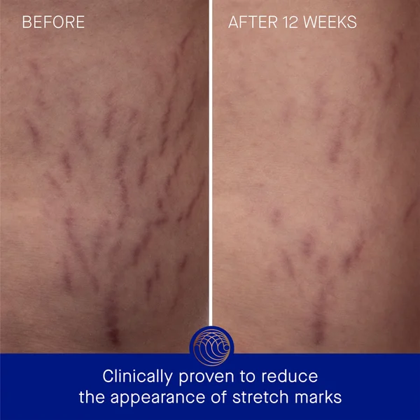 Cult Augustinus Bader The Body Cream 100ml