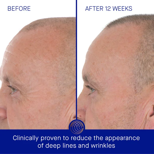 Cult Augustinus Bader The Retinol Serum 30ml