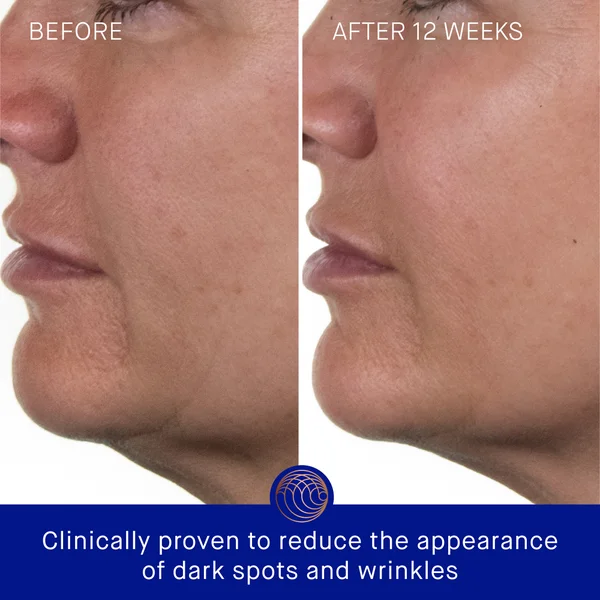 Cult Augustinus Bader The Rich Cream 30ml