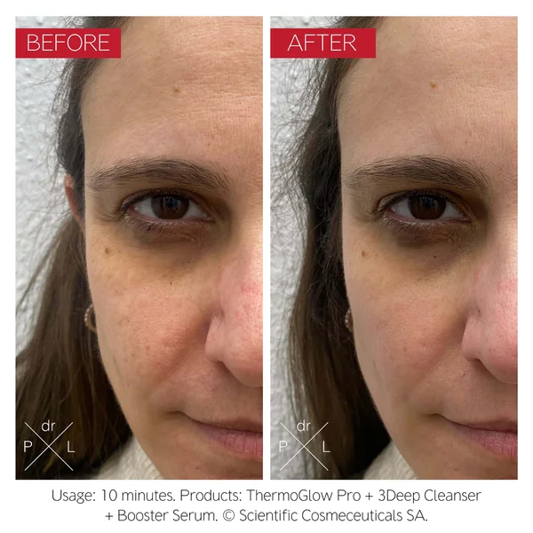 Cult Dr. LEVY Switzerland The ThermoGlow Pro Device