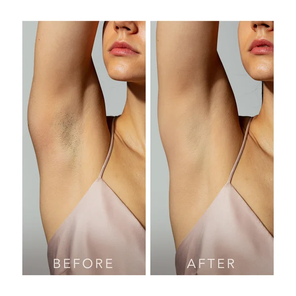 Cult FOREO PEACH 2 Device - Peach