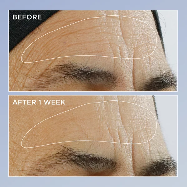 Cult High Potency Triple Retinol Renewal Serum